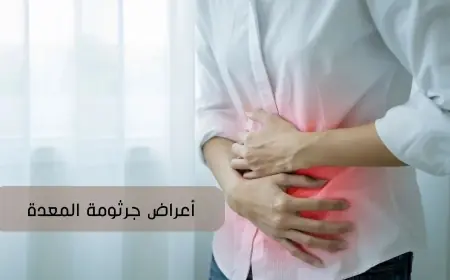 أعراض جرثومة المعدة